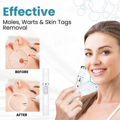 Xorita Non-Invasive Mole and Wart Removal Pen
